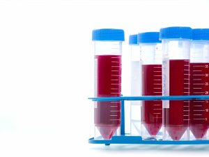 Εξετάσεις αίματος